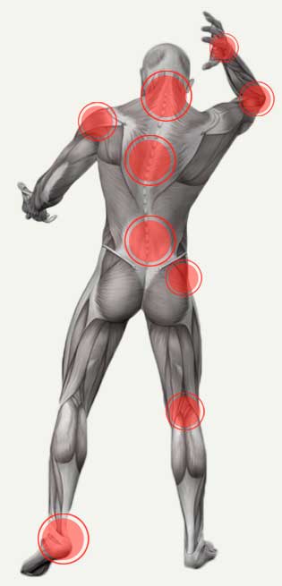 Graphic of pain areas